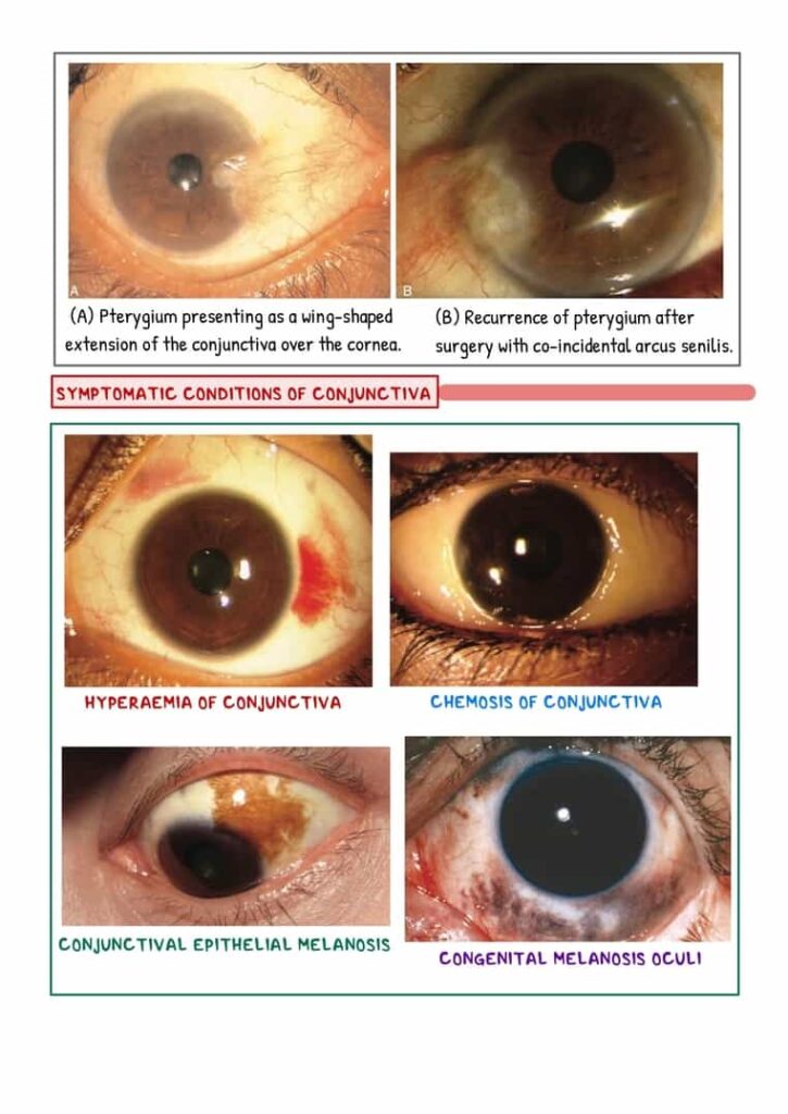 Ophthalmology Image Bank - Notespaedia