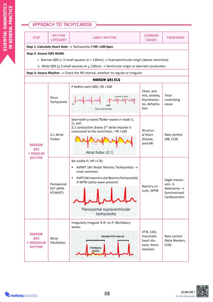 ECG abnormalities