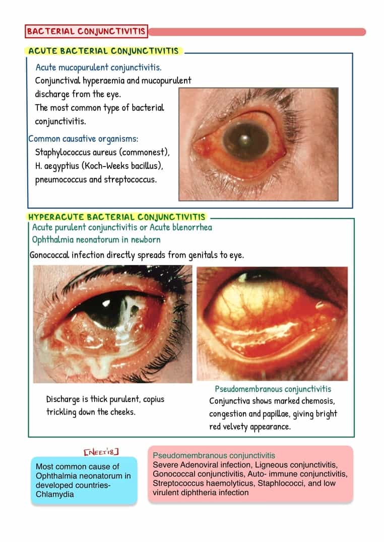 Ophthalmology Image Bank - Image 7