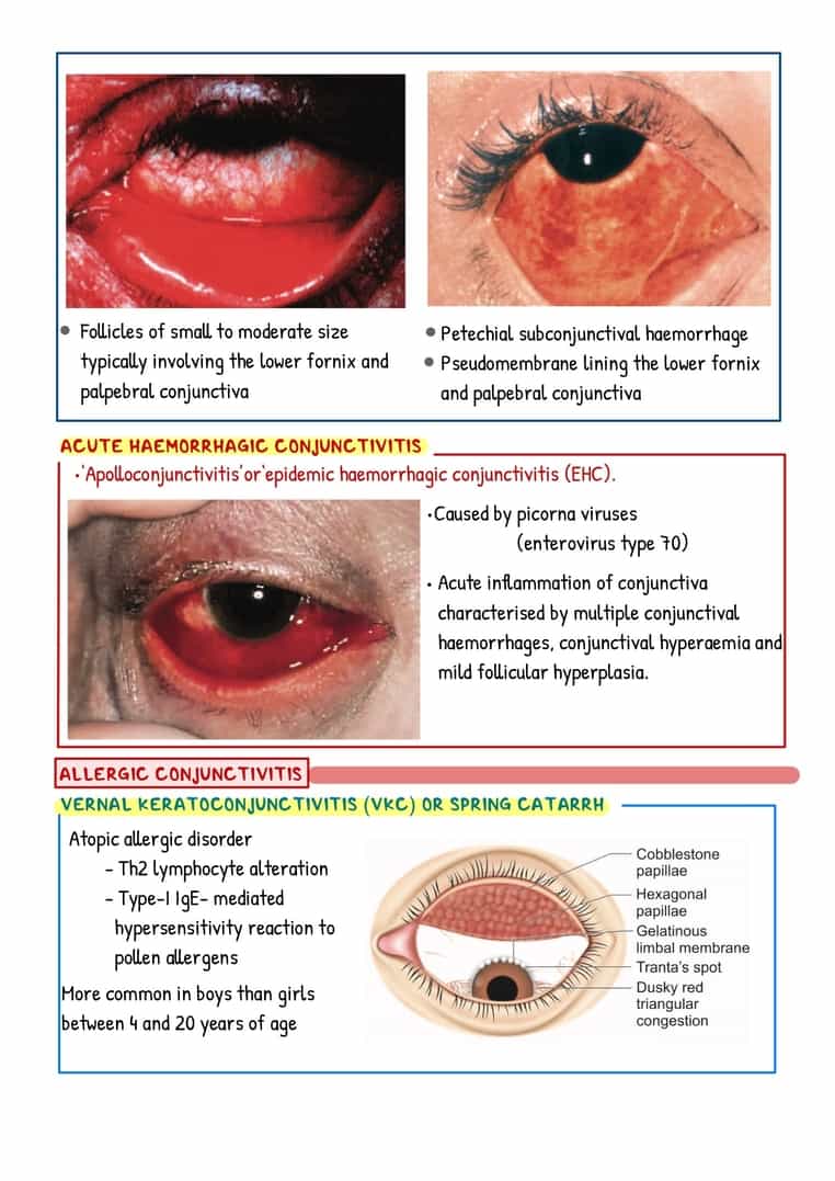 Ophthalmology Image Bank - Image 6